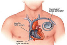 Cancer Hospital Hyderabad, Healthcare Facilities In Hyderabad